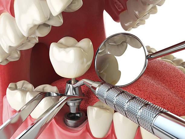 Best Emergency Care for Gum Disease in Pendleton, IN